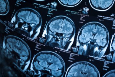 İnsan beyninin, portre resim tıbbi x-ray