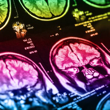 İnsan beyninin, portre resim tıbbi x-ray