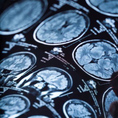 İnsan beyninin, portre resim tıbbi x-ray