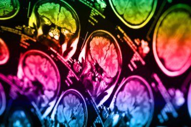 İnsan beyninin, portre resim tıbbi x-ray