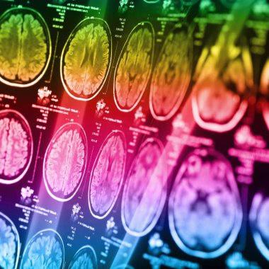 İnsan beyninin, portre resim tıbbi x-ray