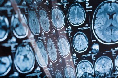 İnsan beyninin, portre resim tıbbi x-ray