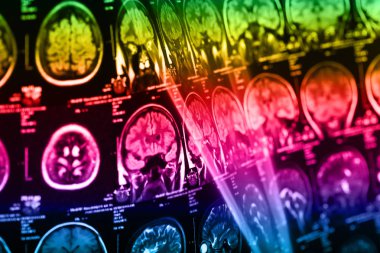 İnsan beyninin, portre resim tıbbi x-ray