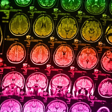 İnsan beyninin, portre resim tıbbi x-ray