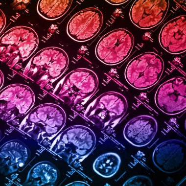 İnsan beyninin, portre resim tıbbi x-ray