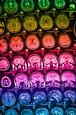 İnsan beyninin, portre resim tıbbi x-ray