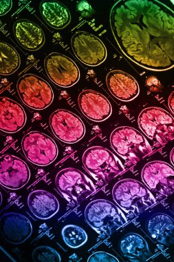 İnsan beyninin, portre resim tıbbi x-ray