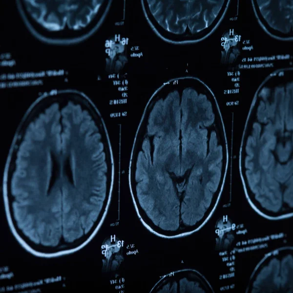 Radiografía Médica Del Cerebro Humano Imagen Primer Plano —  Fotos de Stock