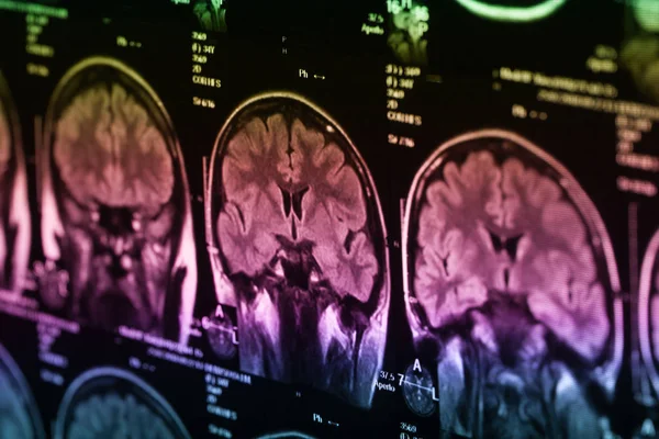 İnsan beyninin, portre resim tıbbi x-ray