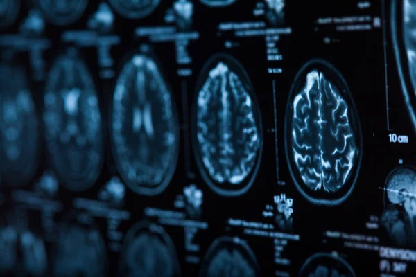 Radiographie Médicale Cerveau Humain Image Rapprochée — Photo