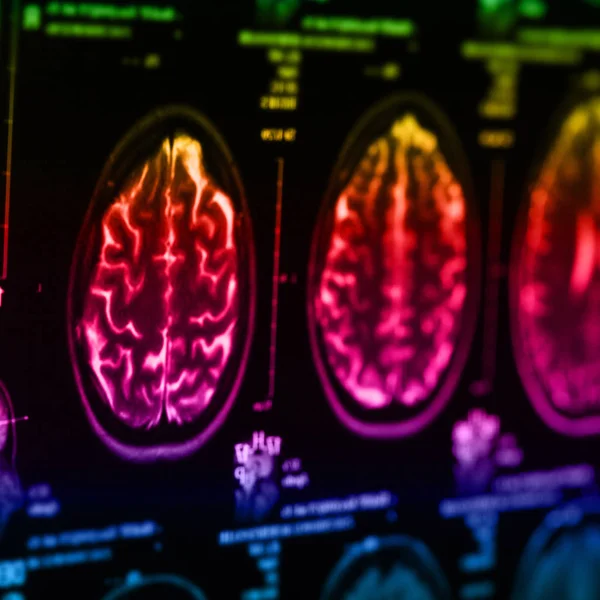 Radiografía Médica Del Cerebro Humano Imagen Primer Plano — Foto de Stock