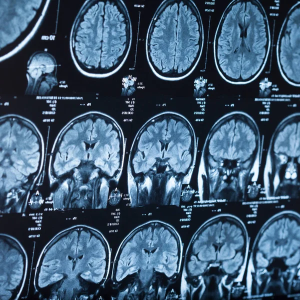 Radiografía Médica Del Cerebro Humano Imagen Primer Plano — Foto de Stock