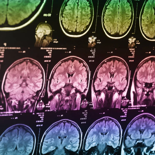 İnsan beyninin, portre resim tıbbi x-ray