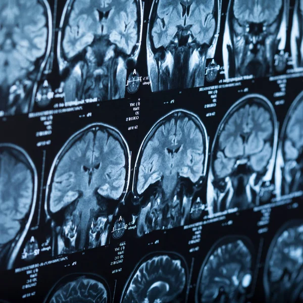 İnsan beyninin, portre resim tıbbi x-ray