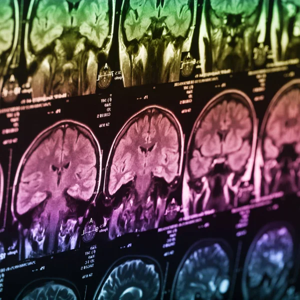 İnsan beyninin, portre resim tıbbi x-ray