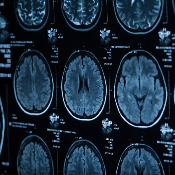 İnsan beyninin, portre resim tıbbi x-ray