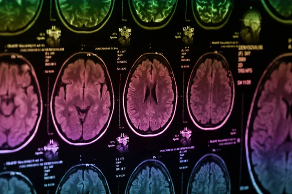 İnsan beyninin, portre resim tıbbi x-ray