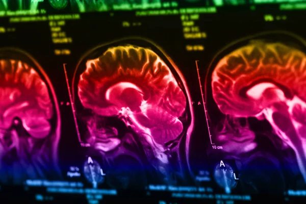 İnsan beyninin, portre resim tıbbi x-ray