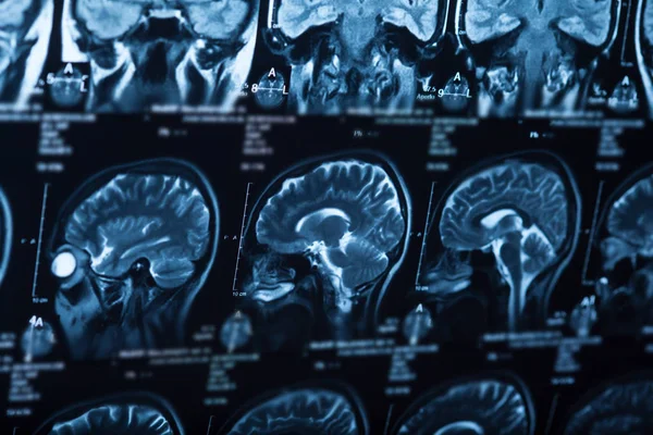 Radiografía Médica Del Cerebro Humano Imagen Primer Plano — Foto de Stock
