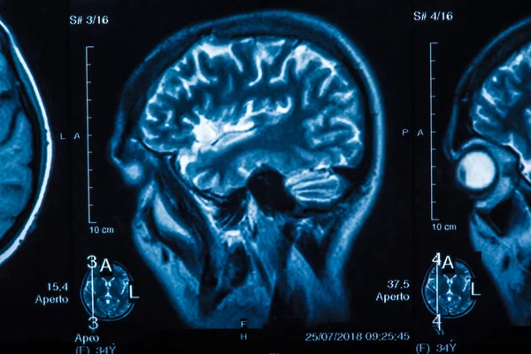 Radiografia Medica Del Cervello Umano Immagine Ravvicinata — Foto Stock