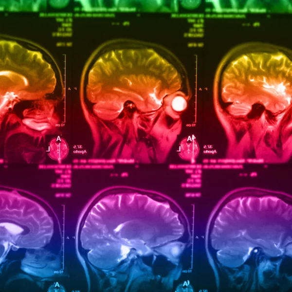 İnsan beyninin, portre resim tıbbi x-ray