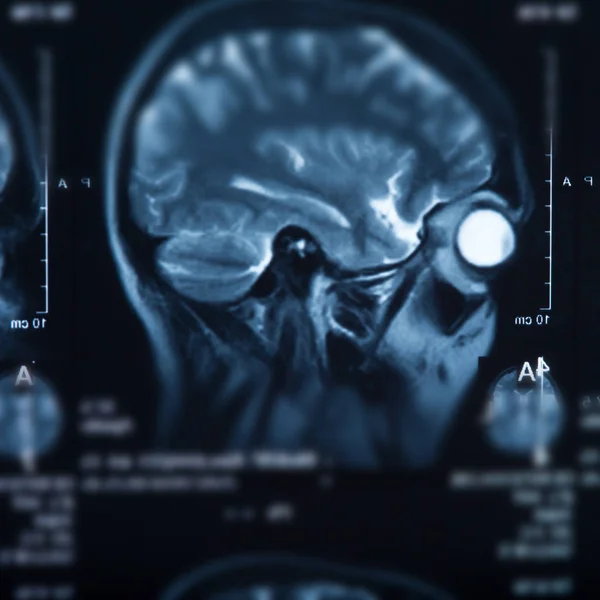 Radiografia Médica Cérebro Humano Imagem Close — Fotografia de Stock