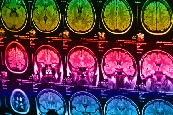 İnsan beyninin, portre resim tıbbi x-ray