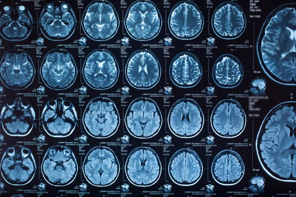 Radiografía Médica Del Cerebro Humano Imagen Primer Plano — Foto de Stock