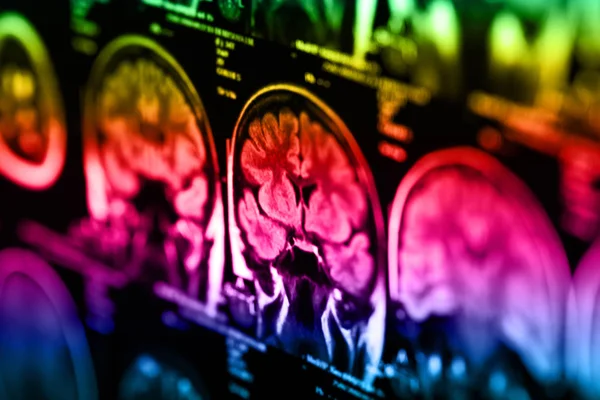 Radiografia Medica Del Cervello Umano Immagine Ravvicinata — Foto Stock