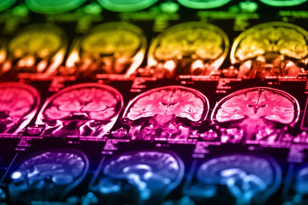 İnsan beyninin, portre resim tıbbi x-ray