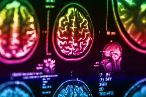 İnsan beyninin, portre resim tıbbi x-ray