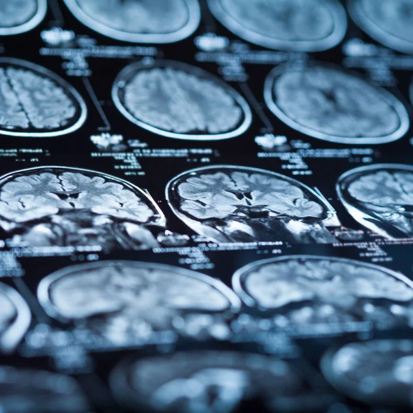 İnsan beyninin, portre resim tıbbi x-ray