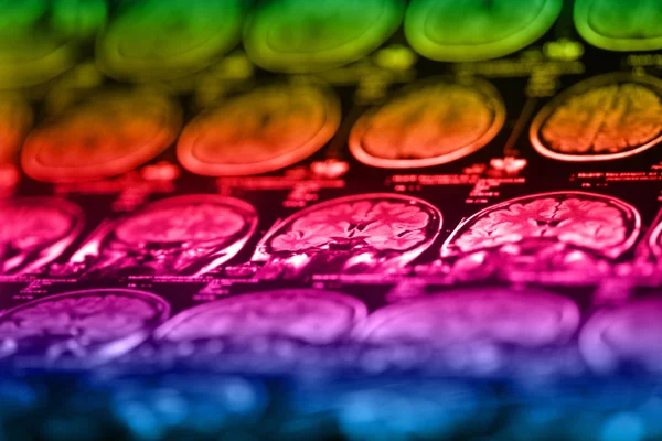 İnsan beyninin, portre resim tıbbi x-ray