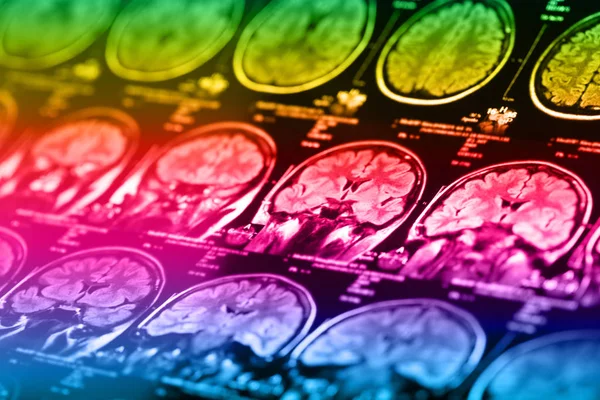 İnsan beyninin, portre resim tıbbi x-ray