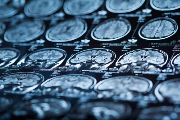 İnsan beyninin, portre resim tıbbi x-ray