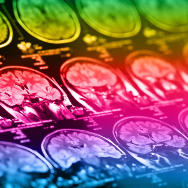 İnsan beyninin, portre resim tıbbi x-ray