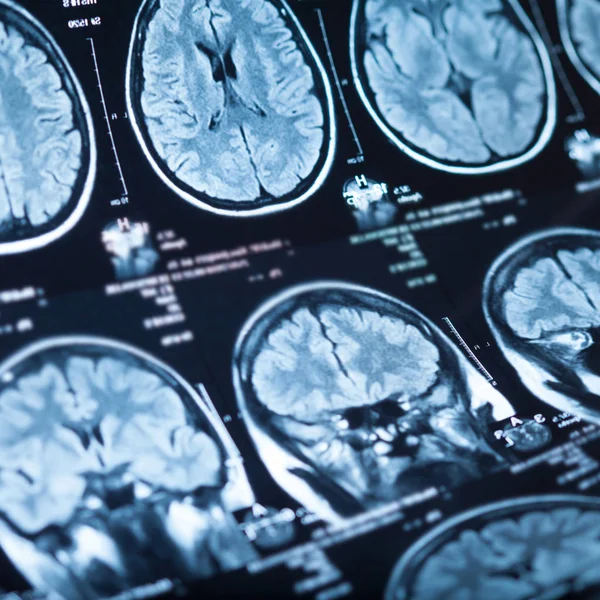 Radiografía Médica Del Cerebro Humano Imagen Primer Plano — Foto de Stock