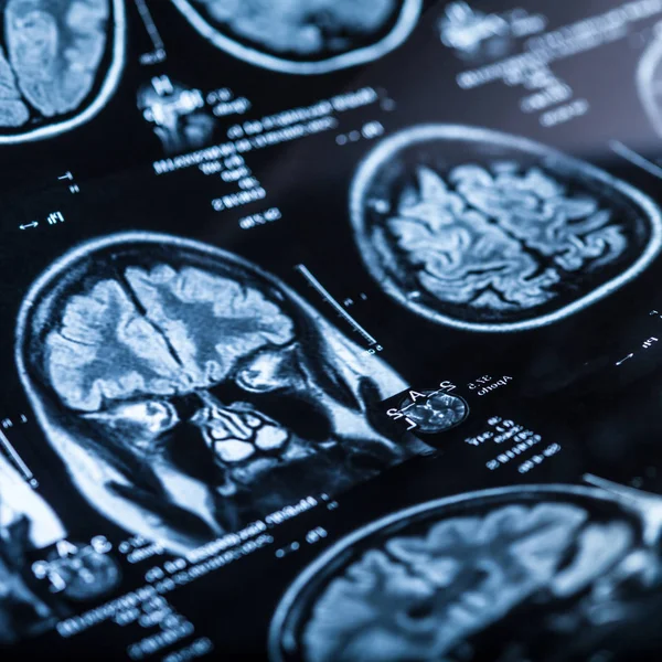 İnsan beyninin, portre resim tıbbi x-ray