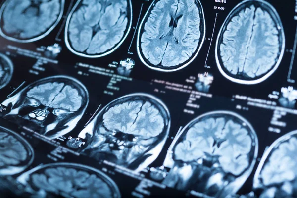 Radiografia Medica Del Cervello Umano Immagine Ravvicinata — Foto Stock