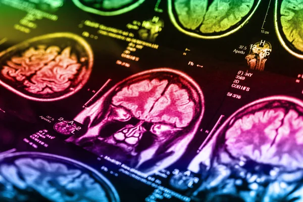 İnsan beyninin, portre resim tıbbi x-ray