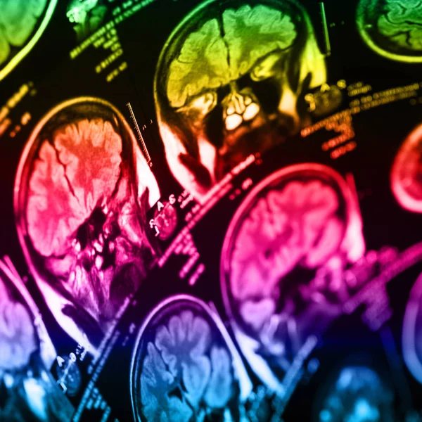 İnsan beyninin, portre resim tıbbi x-ray