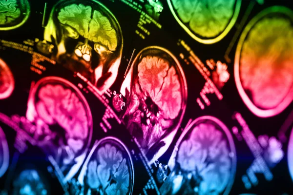 İnsan beyninin, portre resim tıbbi x-ray