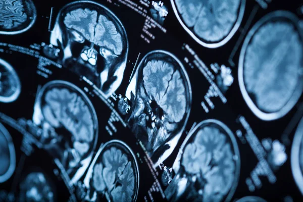 İnsan beyninin, portre resim tıbbi x-ray