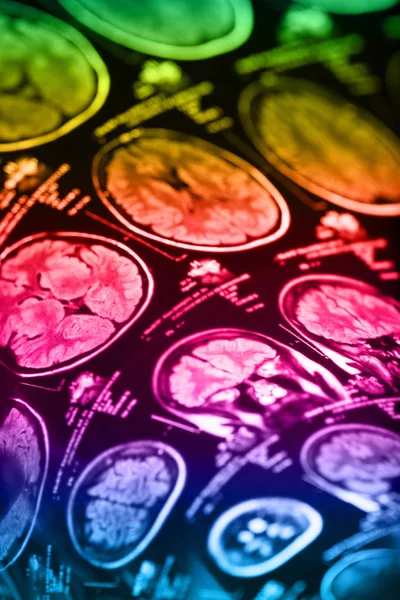 İnsan beyninin, portre resim tıbbi x-ray