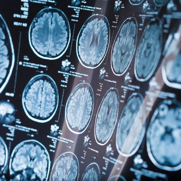 İnsan beyninin, portre resim tıbbi x-ray