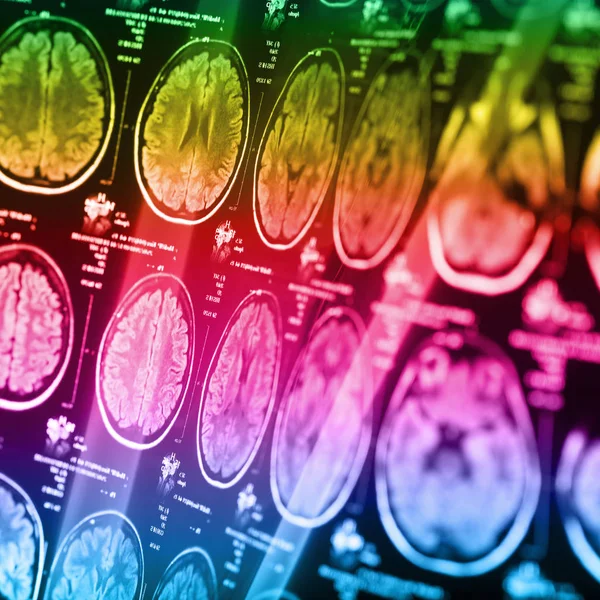 İnsan beyninin, portre resim tıbbi x-ray