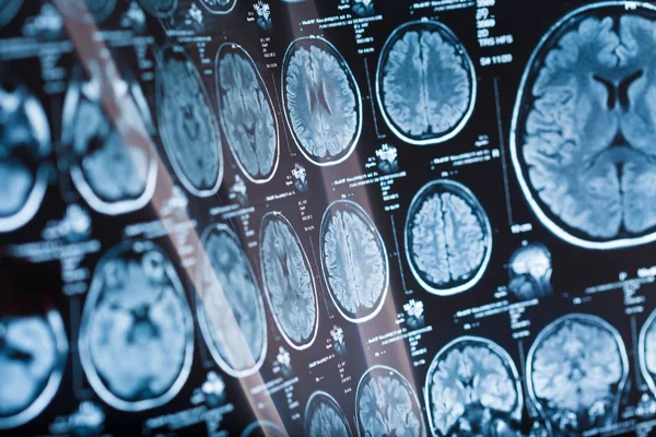 İnsan beyninin, portre resim tıbbi x-ray