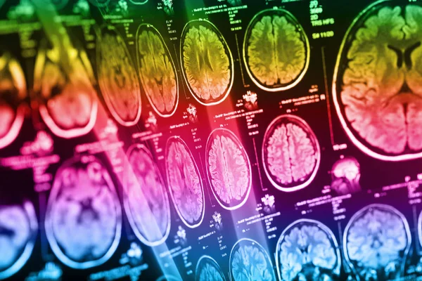 İnsan beyninin, portre resim tıbbi x-ray