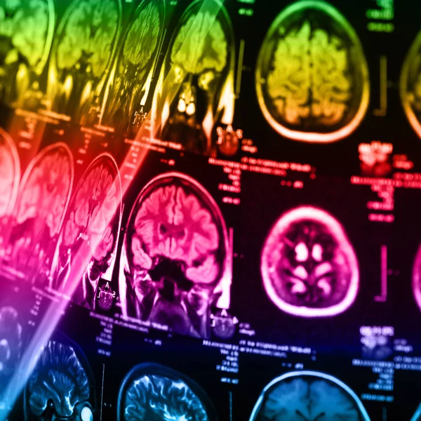 İnsan beyninin, portre resim tıbbi x-ray