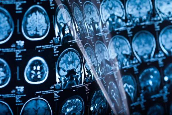 İnsan beyninin, portre resim tıbbi x-ray